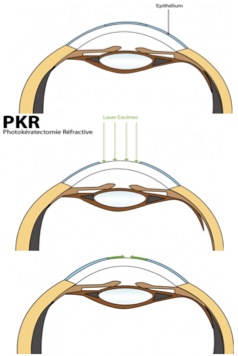 page27-pkr